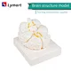 brain ventricles model