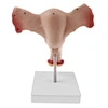 Anatomical uterus model