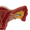 Anatomical uterus model