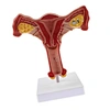Anatomical uterus model