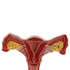 Anatomical uterus model