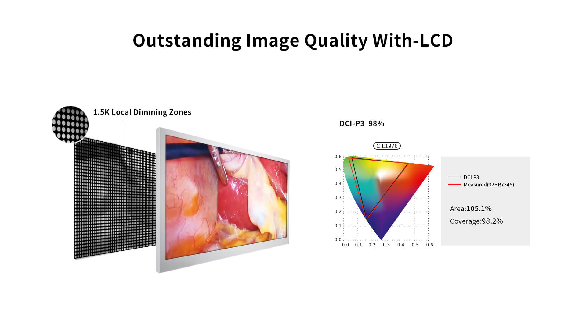 FHD endoscope monitor