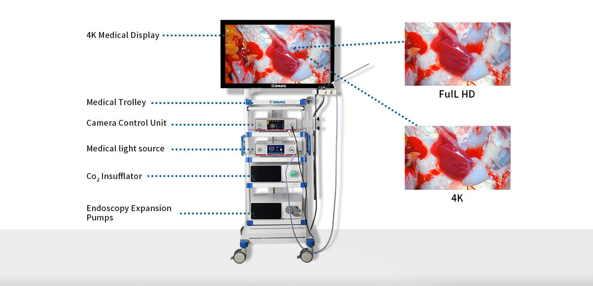 veterinary endoscope camera,4k endoscope camera system,endoscope camera 4k