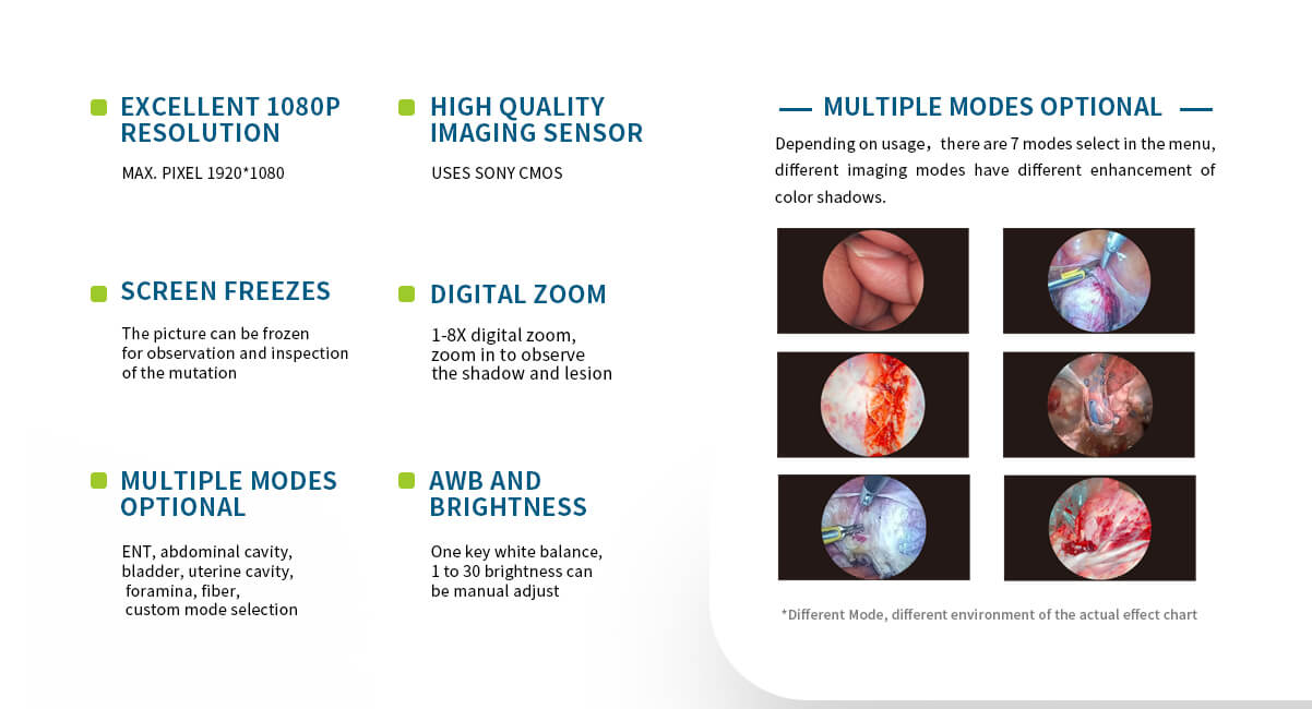 endoscopic hd camera,endoscope camera system full hd,endoscope dental camera