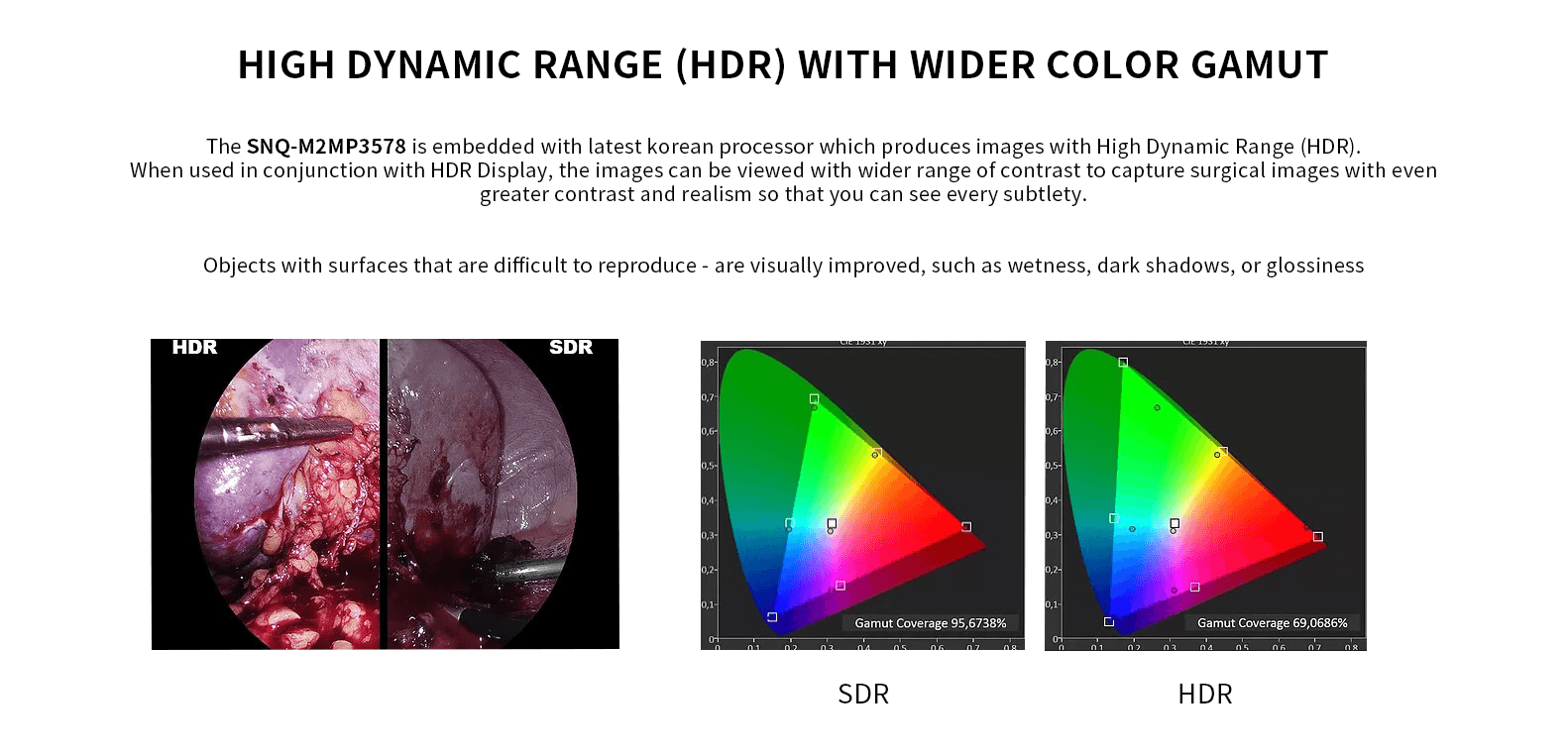 hd endoscop camera,ent nose endoscope camera,hight quality endoscope camera