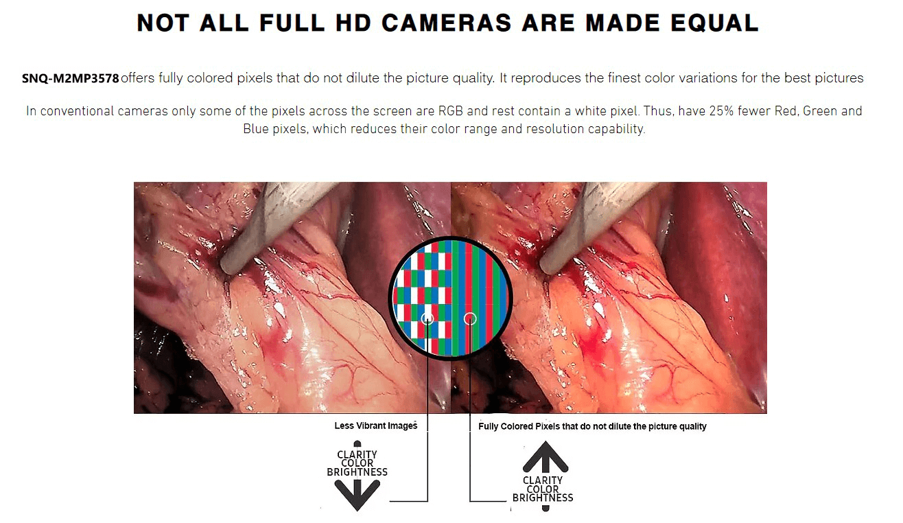 hd endoscop camera,ent nose endoscope camera,hight quality endoscope camera