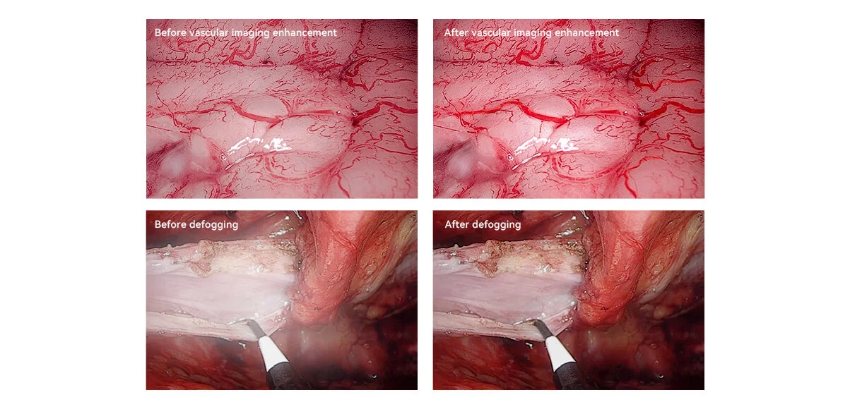 4k endoscope camera,all in one endoscope system,4K endoscope with light source
