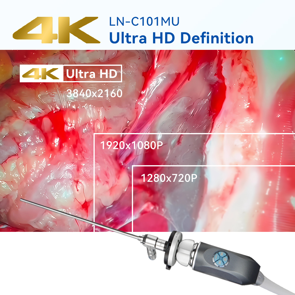 4k endoscope camera,all in one endoscope system,4K endoscope with light source