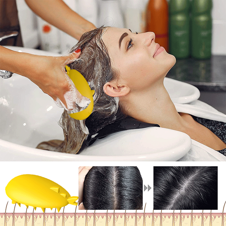 scalp brush dandruff