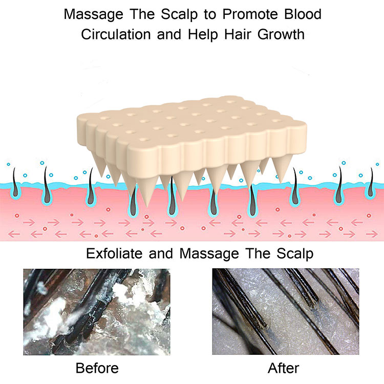 scalp massager for dandruff