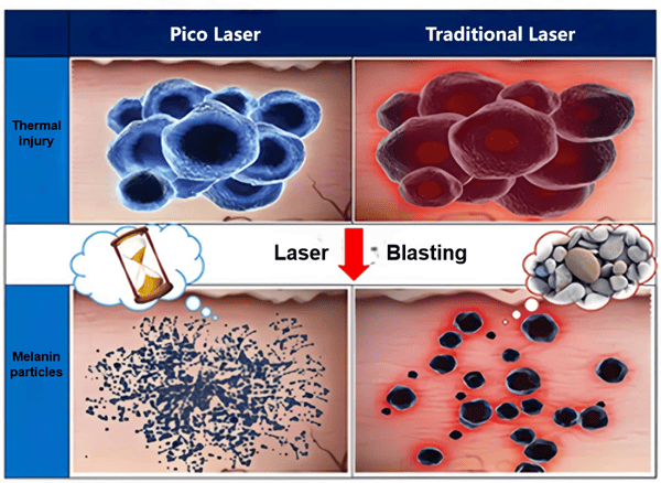 Product demonstration images of the tattoo removal laser machine. 1