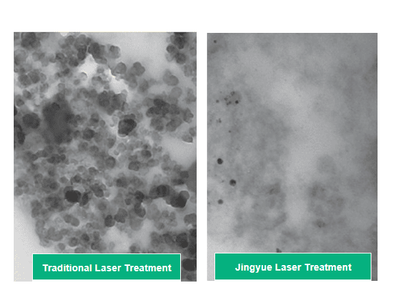 Product demonstration images of the tattoo removal laser machine.