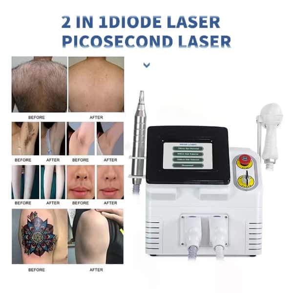 laser equipment for hair removal