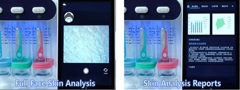 Skin Analysis and Treatment Recommdation
