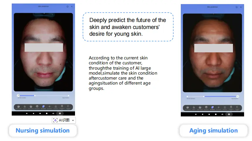 AI Skin Prediction System