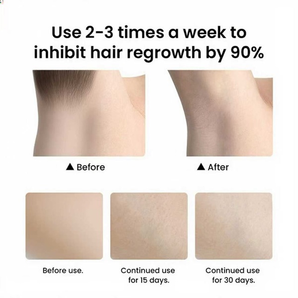 painless hair removal