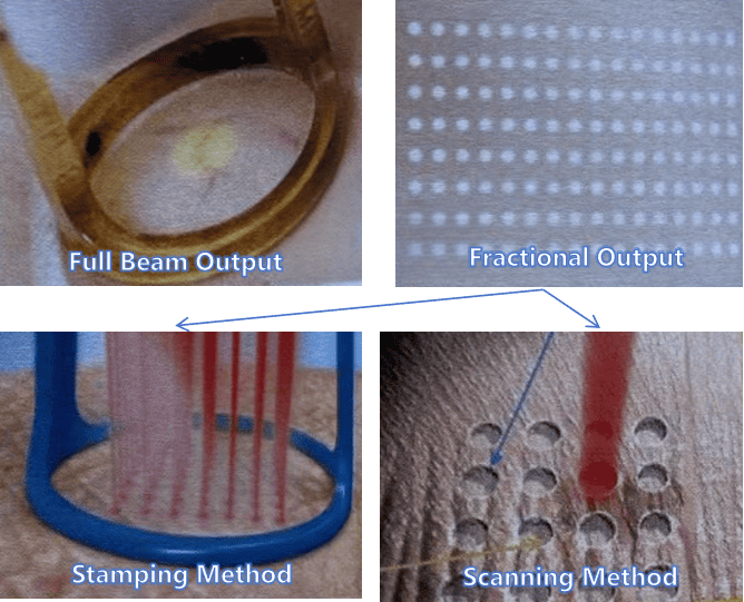 what is fractional laser​