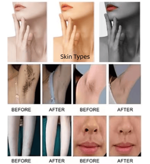 Comparison of results (demonstration image)
