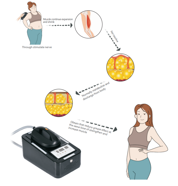Body Slimming Machine Function Diagram 3
