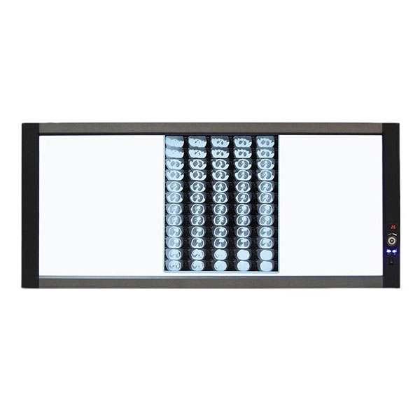 x-ray film