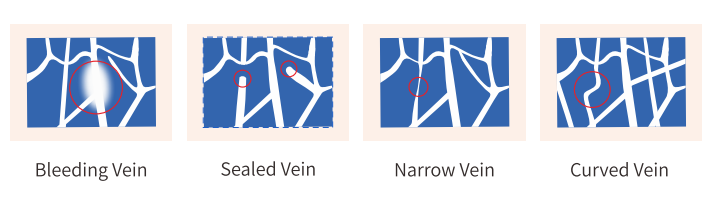 vein finder machine