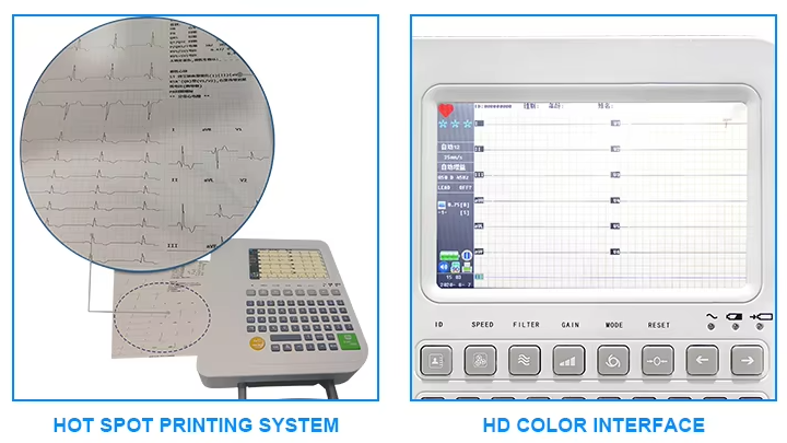 12 channel ECG machine