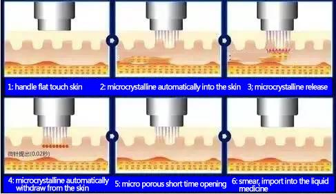 Radio Frequency Microneedling Machine