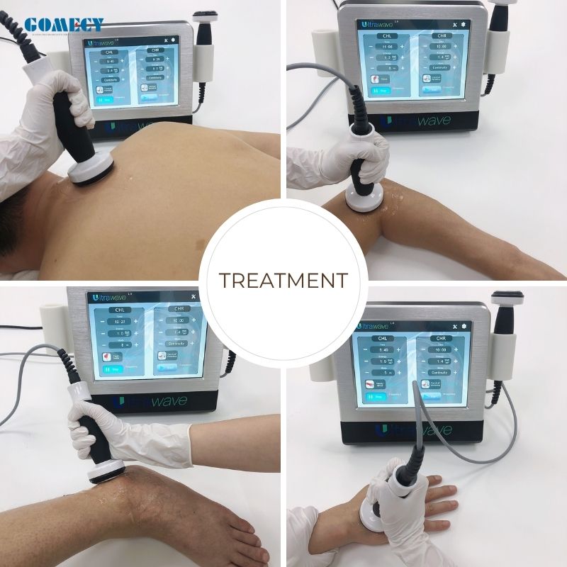 Professional Ultrasound Therapy Equipment