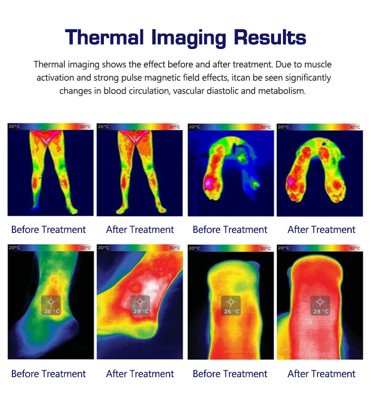 PMST Magnetic Therapy Device