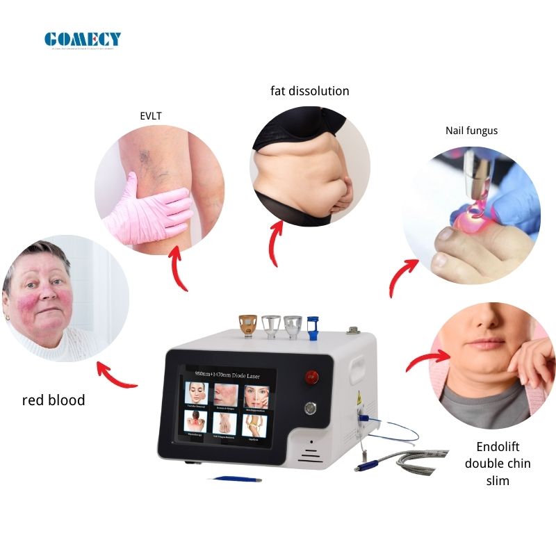980nm-1470nm-6-in-1-multifunctional-laser-beauty-physiotherapy-surgery-treatment-combination