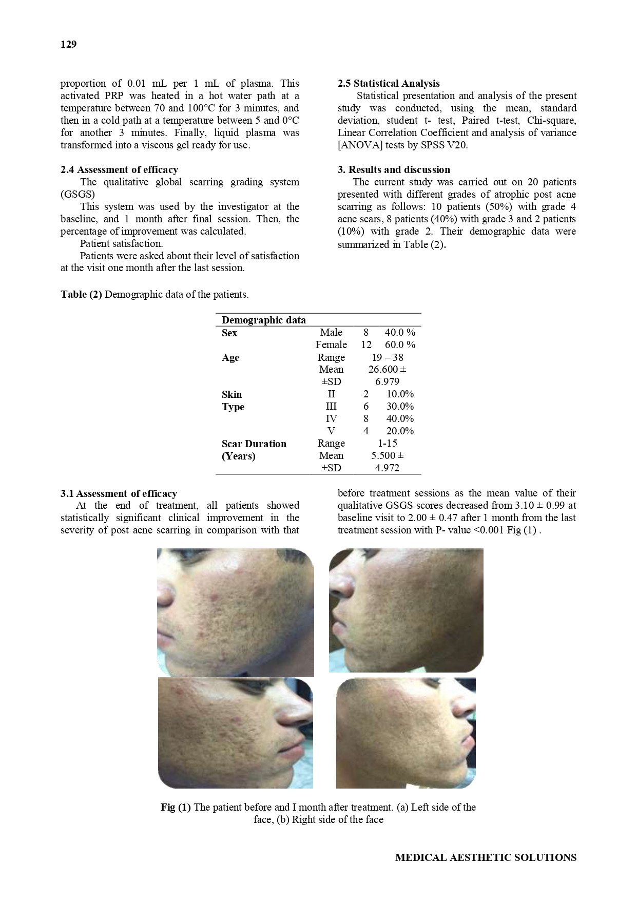 The Efficacy of Combined Plasma Gel and Fractional CO2 Laser in Treatment of Atrophic Acne Scars