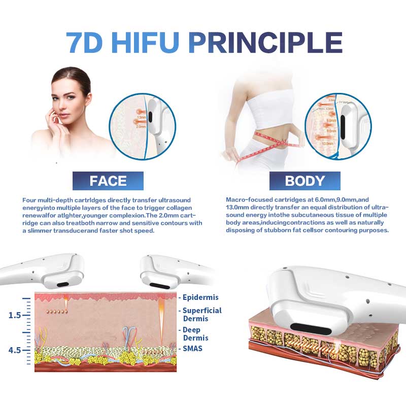 How 7D HIFU work?