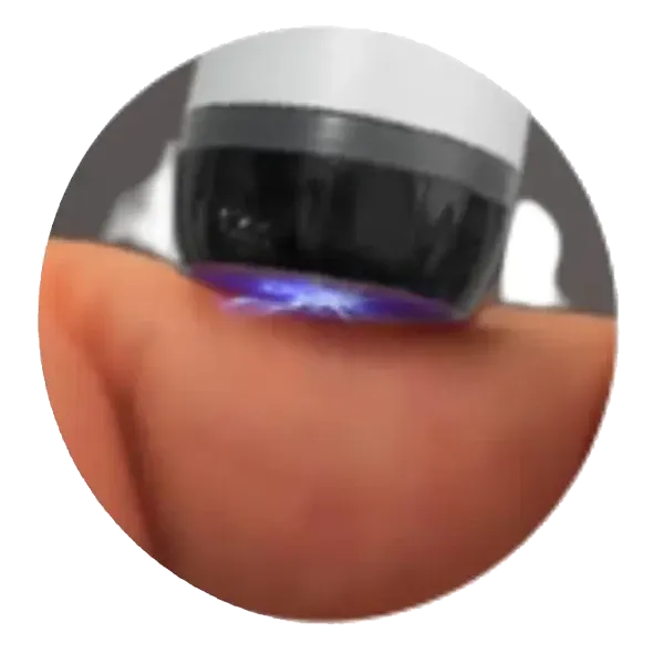 Ceramic Plasma Tip