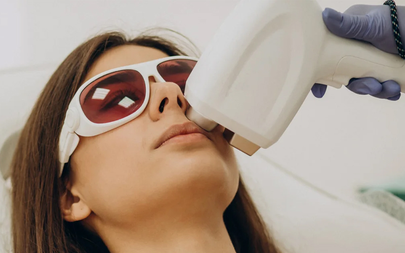 Diode Laser Handles for Hair Removal