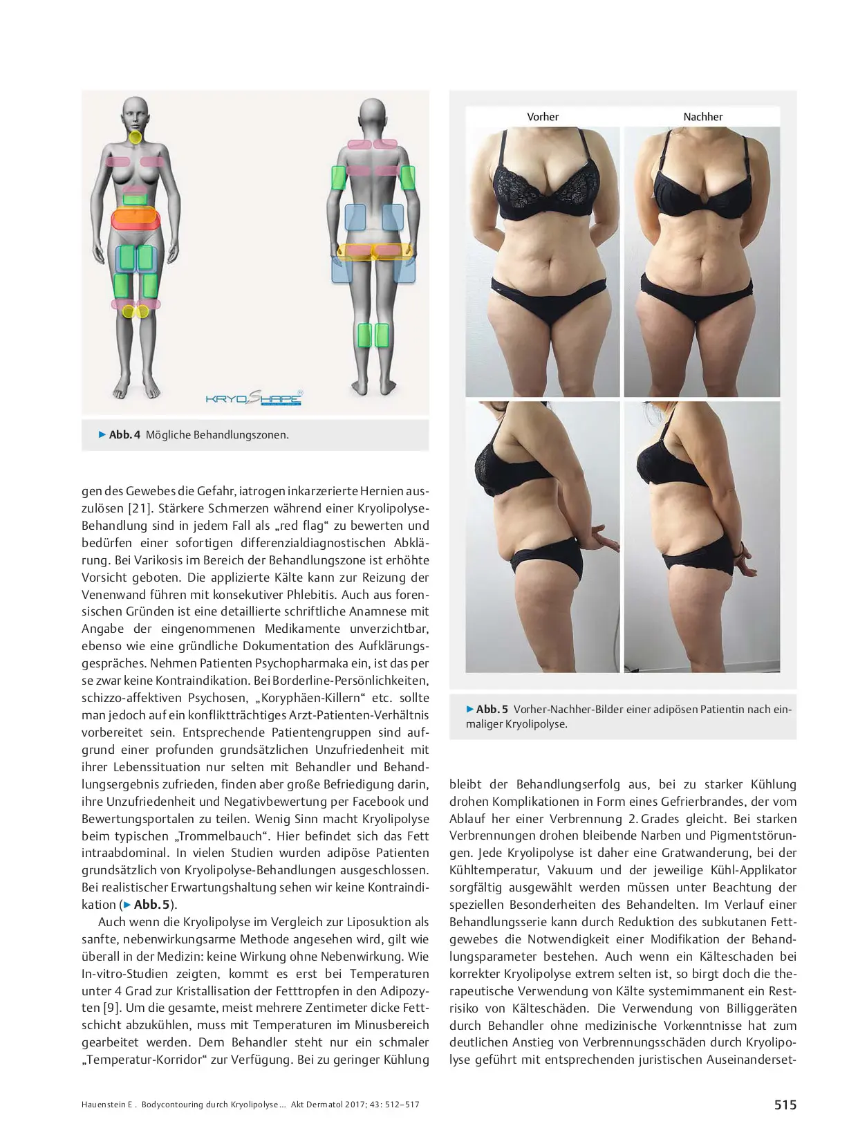 Body Contouring by Cryolipolysis – Research and Practice