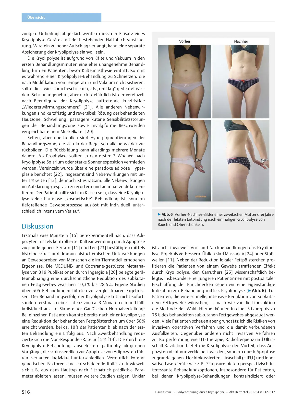 Body Contouring by Cryolipolysis – Research and Practice