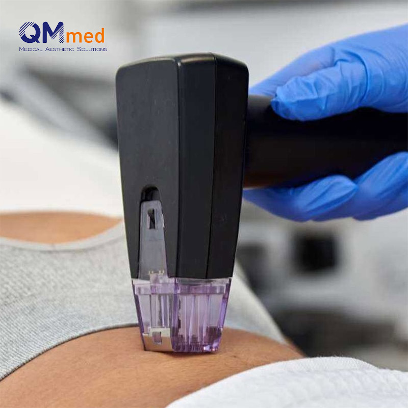 RF microneedling device Application