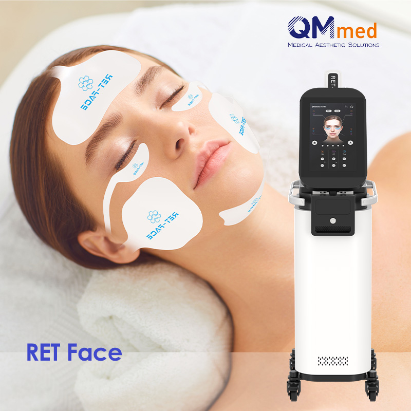 Vertical RET Face