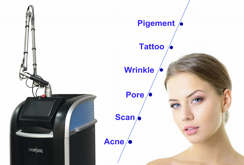 Application of Pico Laser Machine