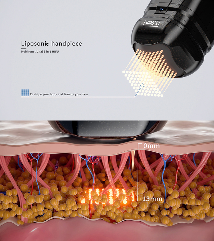 Liposonix Handpiece