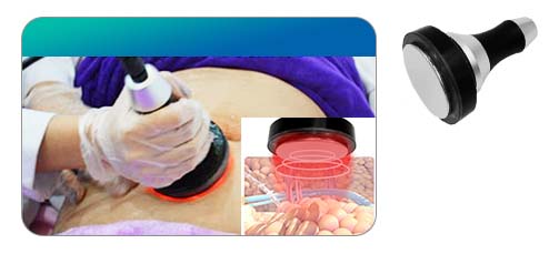 Ultrasound Cavitation