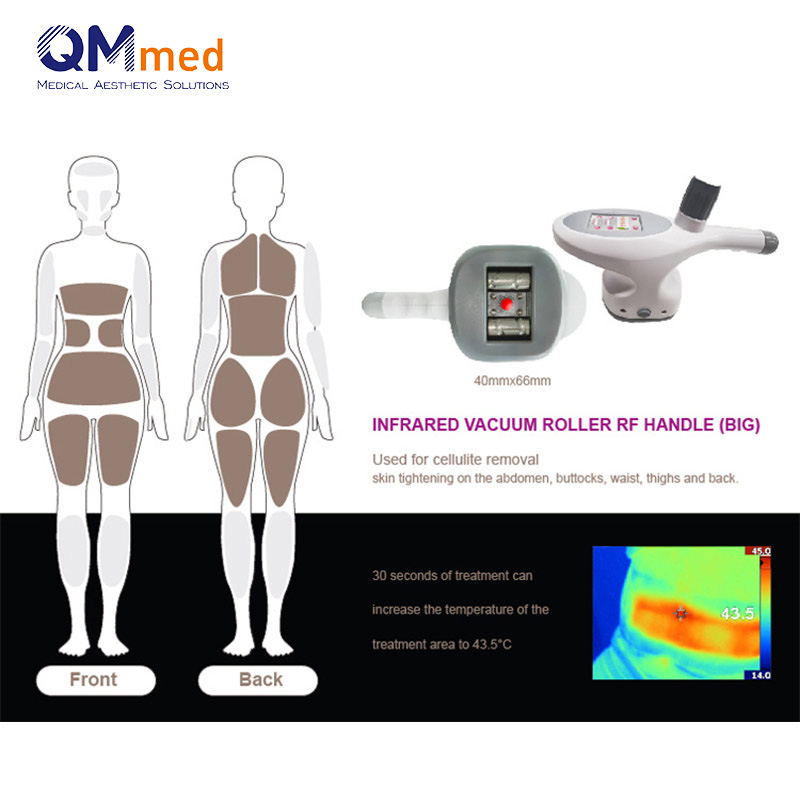 Lipo Contour