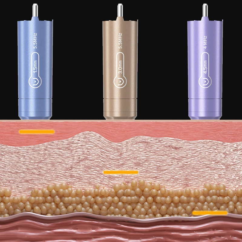 THE RING PROBE ISAPPLIED TO THE SKIN