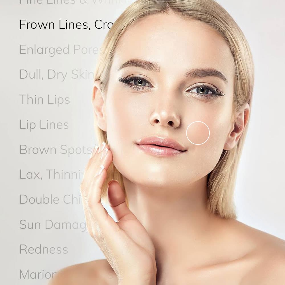 CO2 Fractional Laser Application