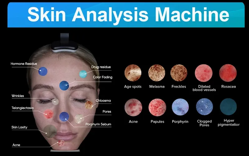 3D Skin analyzer Applications