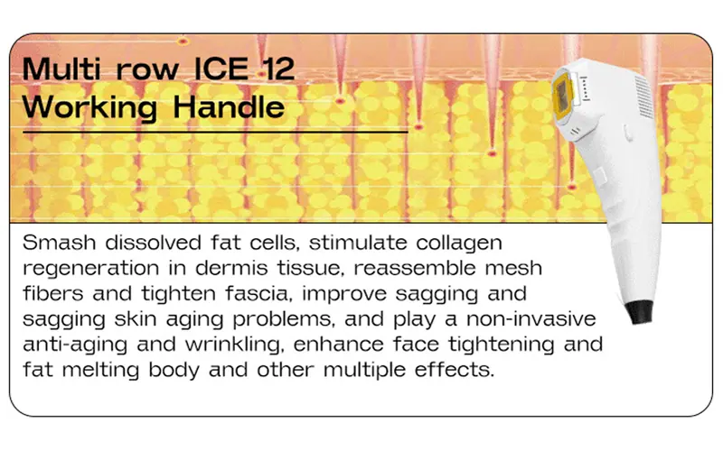 Multi-line ICE HIFU working peinciple