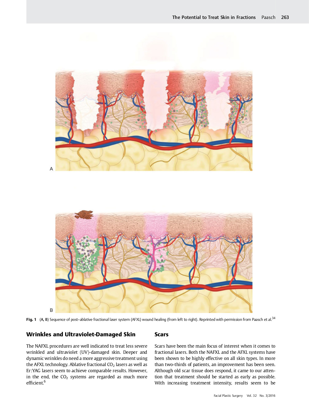 The Future of Fractional Lasers