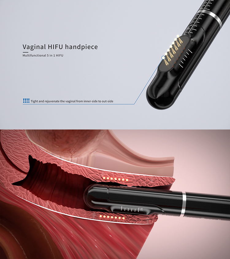 Vaginal HIFU Handpiece