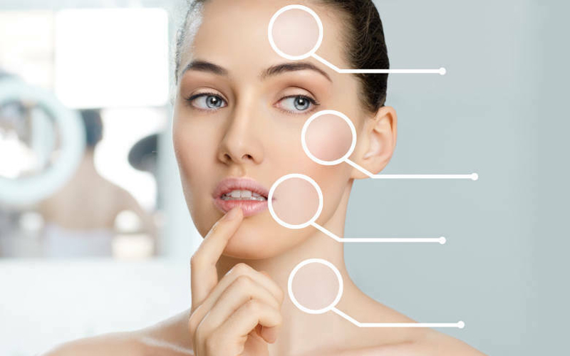 What does CO2 fractional laser treat?