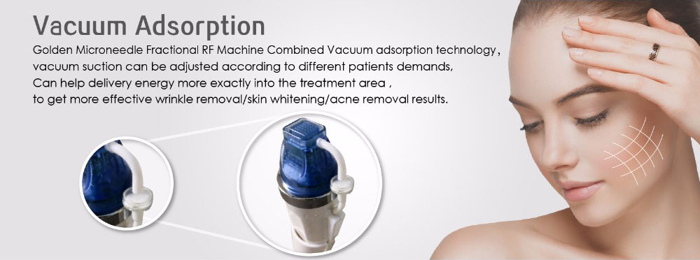 Vacuum Adsorption